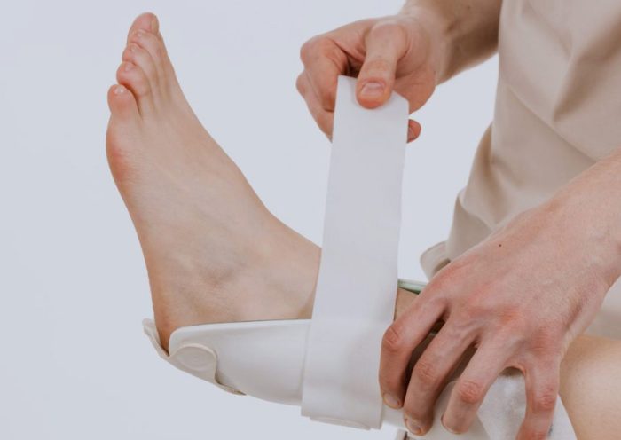 Effective Sprain Treatment Near Me Fast Track Urgent Care Solutions